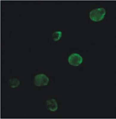 Immunocytochemistry/ Immunofluorescence: Calreticulin Antibody - BSA Free [NB600-101]