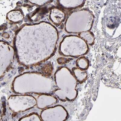 Immunohistochemistry-Paraffin: Calreticulin Antibody [NBP2-48491]