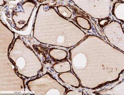Immunohistochemistry-Paraffin: Calreticulin Antibody - BSA Free [NB600-101]