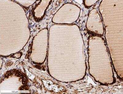 Immunohistochemistry-Paraffin: Calreticulin Antibody - BSA Free [NB600-101]