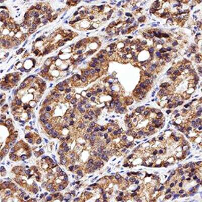 Immunohistochemistry-Paraffin: Calreticulin Antibody [NB600-103]