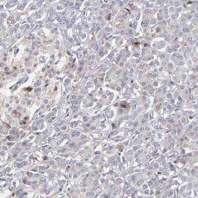 Immunohistochemistry-Paraffin: Calreticulin Antibody [NBP2-48491]