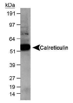 Western Blot: Calreticulin Antibody [NB600-103]