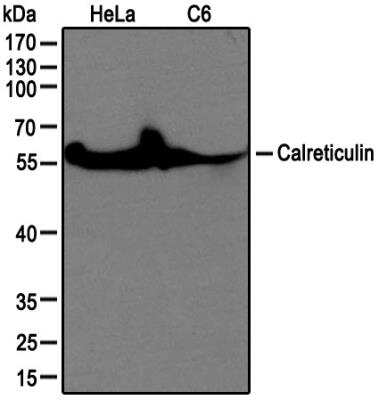 Western Blot: Calreticulin Antibody [NB600-103]