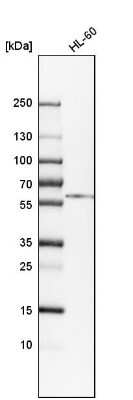 Western Blot: Calreticulin Antibody [NBP2-48491]
