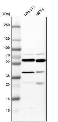 Western Blot: Calreticulin Antibody [NBP2-48491]