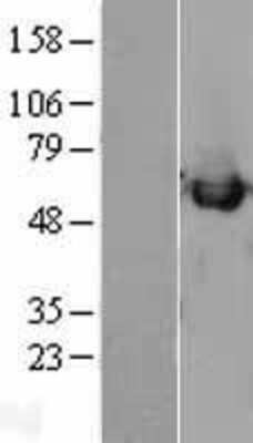 Western Blot: Calreticulin Overexpression Lysate [NBL1-08655]