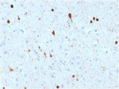 Immunohistochemistry-Paraffin: Calretinin Antibody (CALB2/2602) [NBP3-07365]