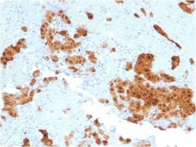 Immunohistochemistry-Paraffin: Calretinin Antibody (CALB2/2602) [NBP3-07365]