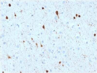 Immunohistochemistry-Paraffin: Calretinin Antibody (CALB2/2602) - Azide and BSA Free [NBP3-08323]