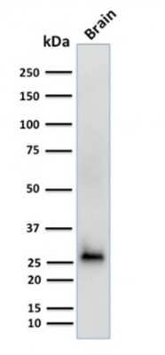 Western Blot: Calretinin Antibody (CALB2/2602) [NBP3-07365]