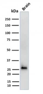 Western Blot: Calretinin Antibody (CALB2/2602)Azide and BSA Free [NBP3-08323]