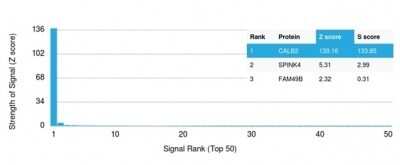 Protein Array: Calretinin Antibody (CALB2/7029R) [NBP3-13799]