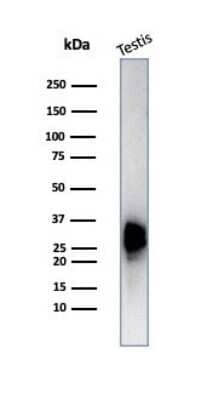 Western Blot: Calretinin Antibody (CALB2/7029R) [NBP3-13799]