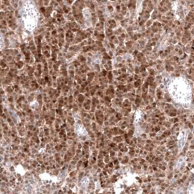 Immunohistochemistry-Paraffin: Calretinin Antibody (CL12836) [NBP3-18575]