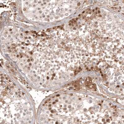 Immunohistochemistry-Paraffin: Calretinin Antibody (CL12836) [NBP3-18575]
