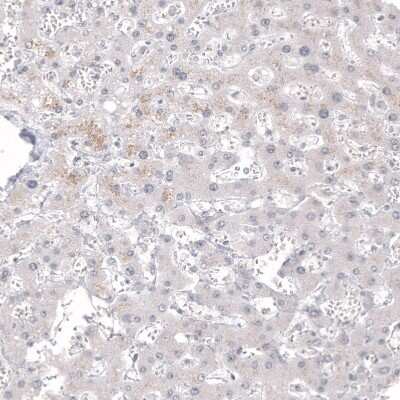 Immunohistochemistry-Paraffin: Calretinin Antibody (CL12836) [NBP3-18575]