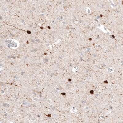 Immunohistochemistry-Paraffin: Calretinin Antibody (CL12838) [NBP3-18561]