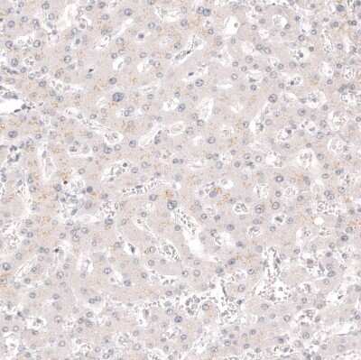 Immunohistochemistry-Paraffin: Calretinin Antibody (CL12838) [NBP3-18561]