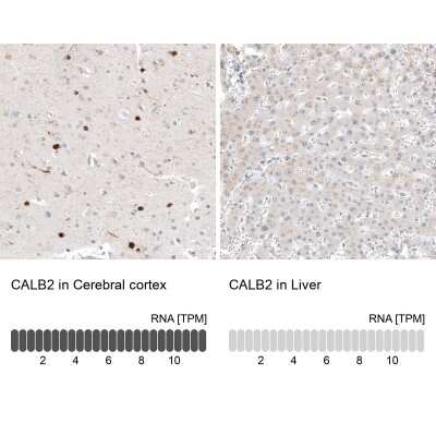 Immunohistochemistry-Paraffin: Calretinin Antibody (CL12842) [NBP3-18545]