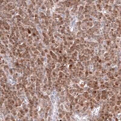 Immunohistochemistry-Paraffin: Calretinin Antibody (CL12842) [NBP3-18545]