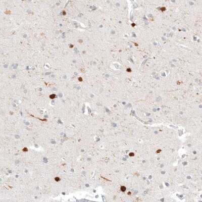 Immunohistochemistry-Paraffin: Calretinin Antibody (CL12842) [NBP3-18545]