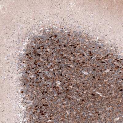 Immunohistochemistry-Paraffin: Calretinin Antibody (CL12842) [NBP3-18545]