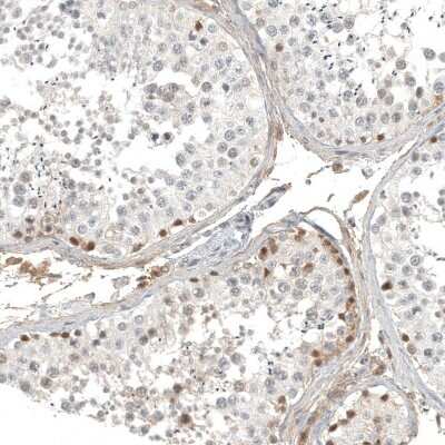 Immunohistochemistry-Paraffin: Calretinin Antibody (CL12842) [NBP3-18545]