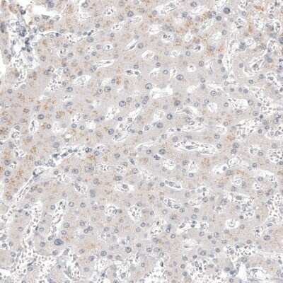 Immunohistochemistry-Paraffin: Calretinin Antibody (CL12842) [NBP3-18545]
