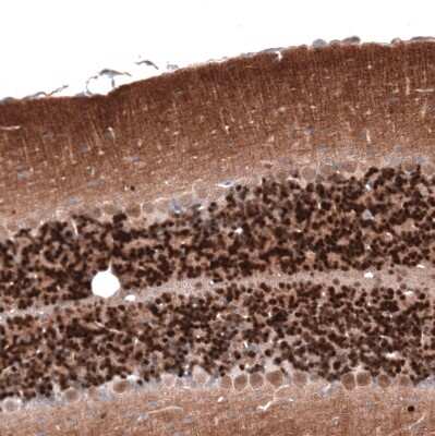 Immunohistochemistry-Paraffin: Calretinin Antibody (CL12842) [NBP3-18545]