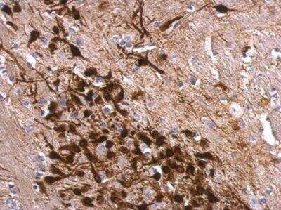 Immunohistochemistry-Paraffin: Calretinin Antibody [NBP1-32244]