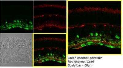 Immunohistochemistry-Paraffin: Calretinin Antibody [NBP1-32244]