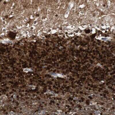 Immunohistochemistry-Paraffin: Calretinin Antibody [NBP1-88220]