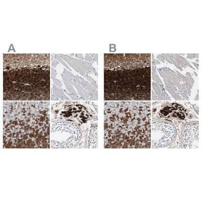Immunohistochemistry-Paraffin: Calretinin Antibody [NBP1-88220]