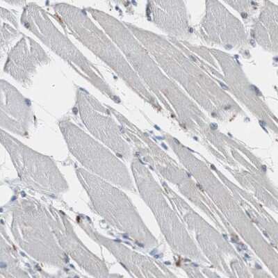 Immunohistochemistry-Paraffin: Calretinin Antibody [NBP1-88220]