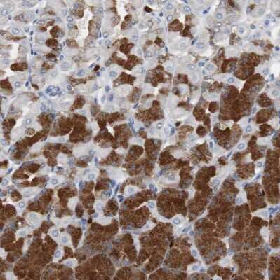 Immunohistochemistry-Paraffin: Calretinin Antibody [NBP1-88220]