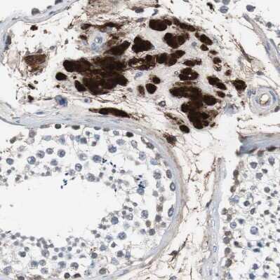 Immunohistochemistry-Paraffin: Calretinin Antibody [NBP1-88220]