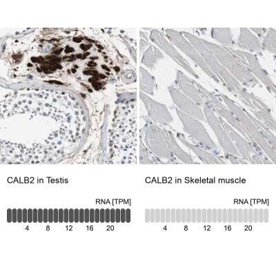 Immunohistochemistry-Paraffin: Calretinin Antibody [NBP1-88220]