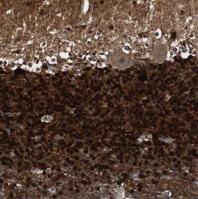 Immunohistochemistry-Paraffin: Calretinin Antibody [NBP1-88221]