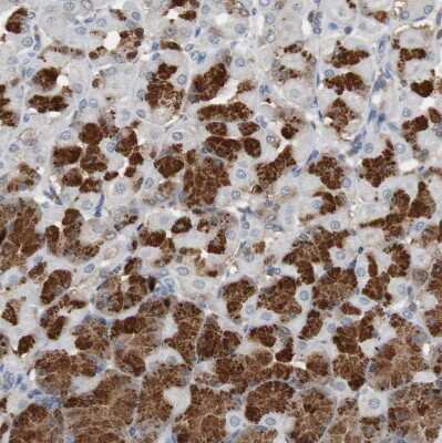 Immunohistochemistry-Paraffin: Calretinin Antibody [NBP1-88221]