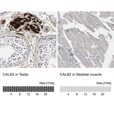 Immunohistochemistry-Paraffin: Calretinin Antibody [NBP1-88221]