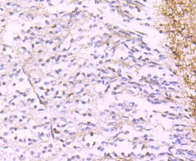 Immunohistochemistry-Paraffin: Calretinin Antibody (JM12-93) [NBP2-67206]