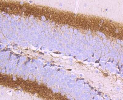 Immunohistochemistry-Paraffin: Calretinin Antibody (JM12-93) [NBP2-67206]