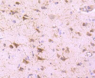 Immunohistochemistry-Paraffin: Calretinin Antibody (JM12-93) [NBP2-67206]