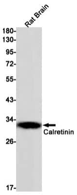 Western Blot: Calretinin Antibody (S01-2G7) [NBP3-19588]