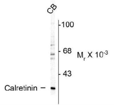 Western Blot: Calretinin AntibodyAzide and BSA Free [NBP1-30050]