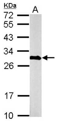 Western Blot: Calretinin Antibody [NBP1-32244]