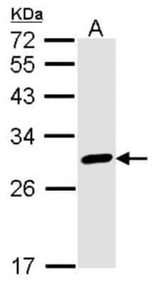 Western Blot: Calretinin Antibody [NBP1-32244]