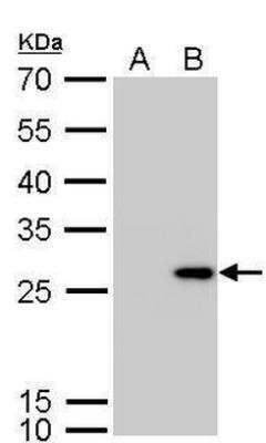 Western Blot: Calretinin Antibody [NBP1-32244]