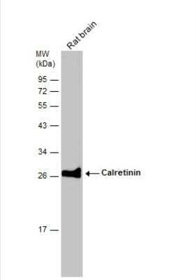 Western Blot: Calretinin Antibody [NBP1-32244]